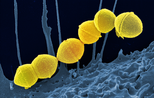 Colorized scanning electron micrograph of Group A Streptococcus (Streptococcus pyogenes) bacteria (yellow) and a human neutrophil (blue). Credit: NIAID